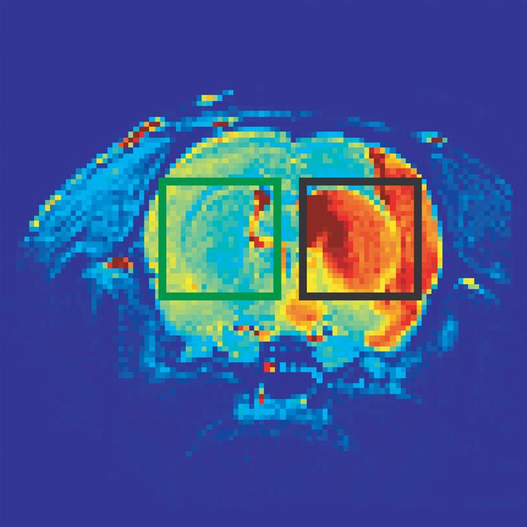 הדמיה באמצעות תהודה מגנטית של מוח חולדה, בו נגרם שבץ בחלקו הימני (מסגרת שחורה); חלקו השמאלי לא נפגע (מסגרת ירוקה)